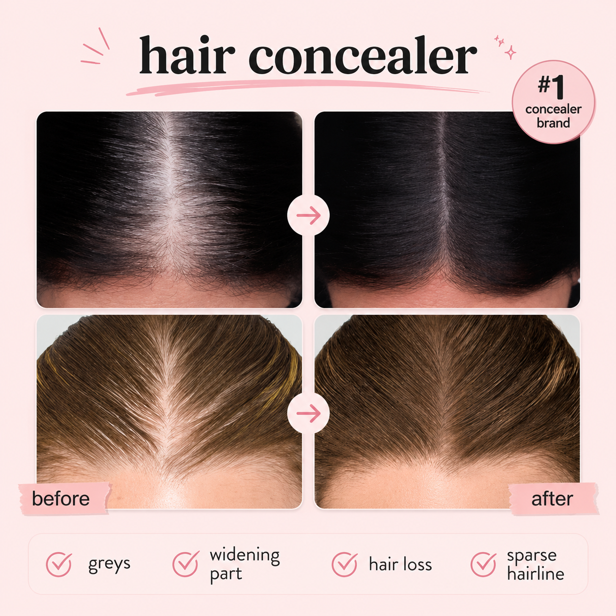Artuift Hair Concealer – Instant Root & Hairline Coverage💖