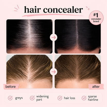 Artuift Hair Concealer – Instant Root & Hairline Coverage💖