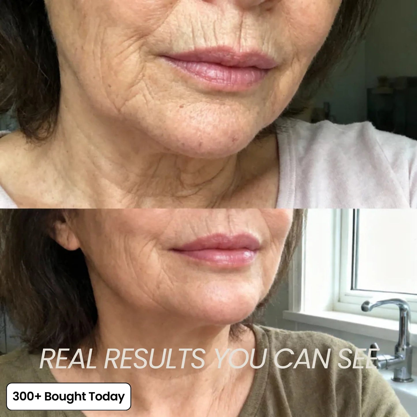 (🔥LAST DAY B2G1 FREE)Artuift Korean PDRN Pink Collagen Volume Multi Balm