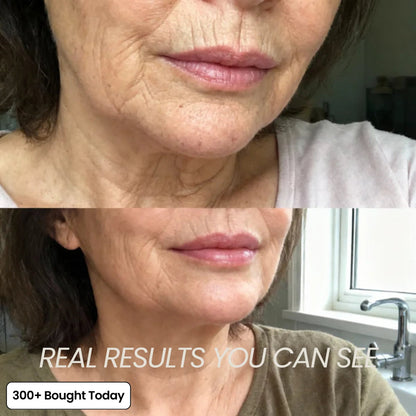 (🔥LAST DAY B2G1 FREE)Artuift Korean PDRN Pink Collagen Volume Multi Balm