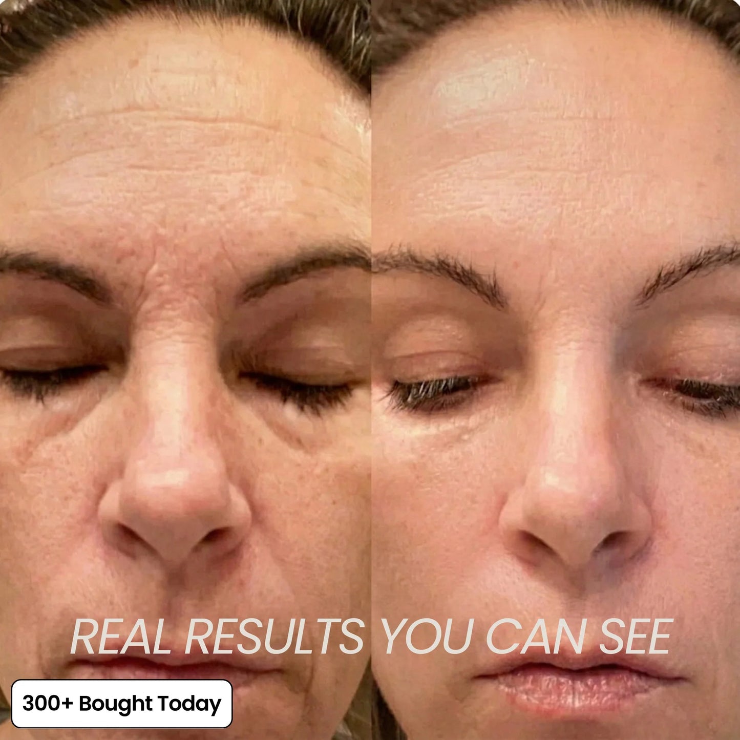 (🔥LAST DAY B2G1 FREE)Artuift Korean PDRN Pink Collagen Volume Multi Balm