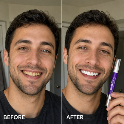 🦷 SmileFitPro PAP+ Purple Teeth Whitening Pen 💜