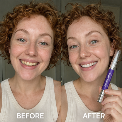🦷 SmileFitPro PAP+ Purple Teeth Whitening Pen 💜