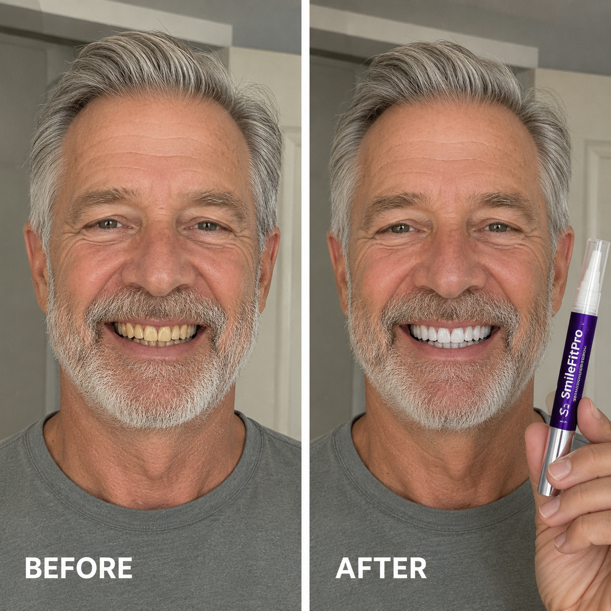 🦷 SmileFitPro PAP+ Purple Teeth Whitening Pen 💜