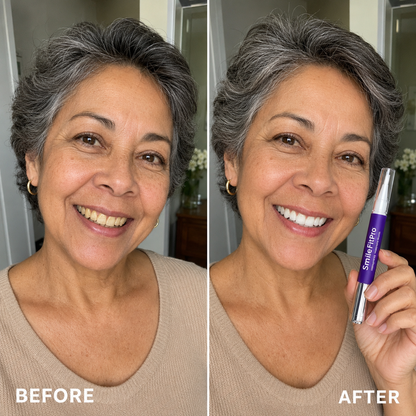🦷 SmileFitPro PAP+ Purple Teeth Whitening Pen 💜